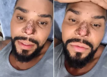 NECROSE NO NAIRZ DO CANTOR NALDO PREOCUPA