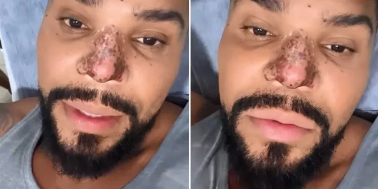 NECROSE NO NAIRZ DO CANTOR NALDO PREOCUPA