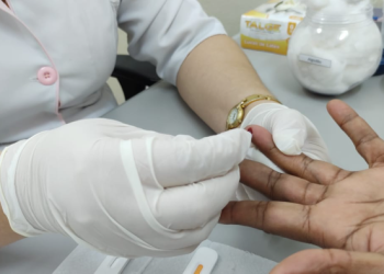 RESENDE OFERECE A PARTIR DE HOJE TESTES RÁPIDOS DE HIV, SÍFILIS E HEPATITE B e C