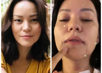EX-ANGELICAT GEOVANNA TOMINAGA ASSUSTOU SEUS FÃS AO PASSAR POR PROCEDIMENTO CIRÚRGICO DE EMERGÊNCIA