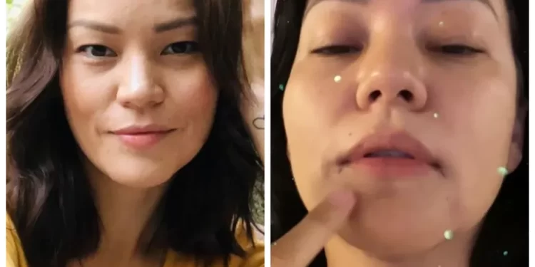 EX-ANGELICAT GEOVANNA TOMINAGA ASSUSTOU SEUS FÃS AO PASSAR POR PROCEDIMENTO CIRÚRGICO DE EMERGÊNCIA