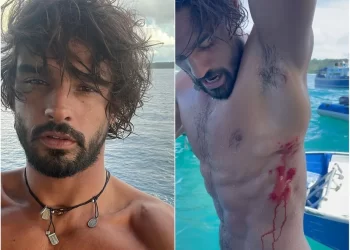 AO SURFAR NA INDONÉSIA MARLON TEIXEIRA SOFRE ACIDENTE
