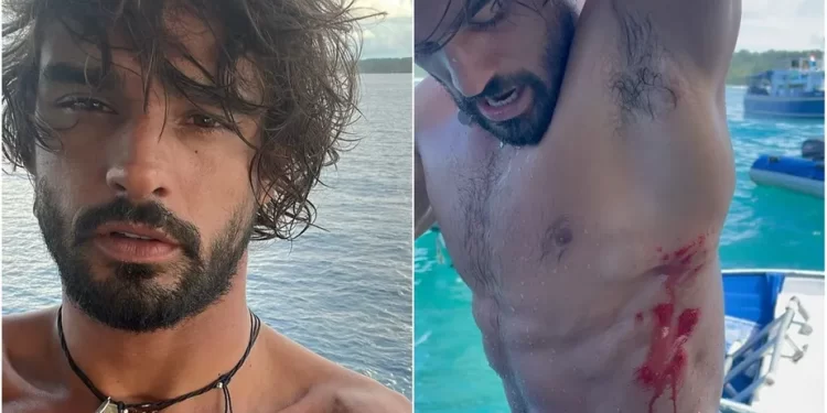 AO SURFAR NA INDONÉSIA MARLON TEIXEIRA SOFRE ACIDENTE