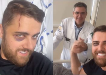 Zé Neto, da dupla com Cristiano, em tratamento a laser para remover cicatriz de acidente de kart