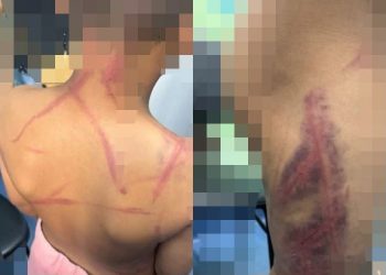 PAIS SÃO PRESOS POR ESPANCAR CRIANÇA DE 9 ANOS EM SÃO JOÃO DE MERITI