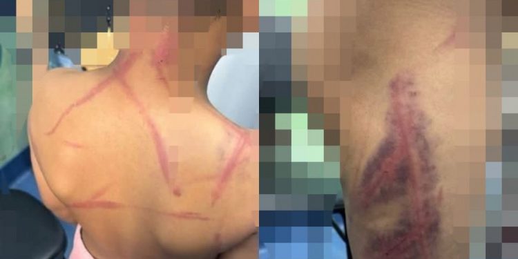 PAIS SÃO PRESOS POR ESPANCAR CRIANÇA DE 9 ANOS EM SÃO JOÃO DE MERITI